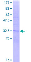 12.5% SDS-PAGE Stained with Coomassie Blue.
